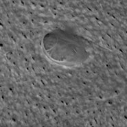 (Figure 2) SEM image of lacunae structure.