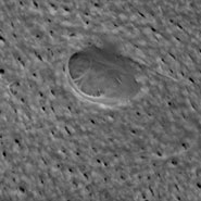 (Figure 2) SEM image of lacunae structure.