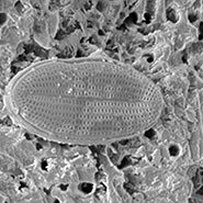 (Figure 2) SEM image of diatom structure on seashell surface.